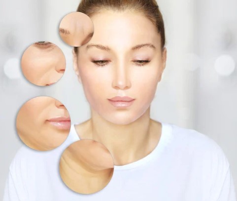 ほうれい線イメージ