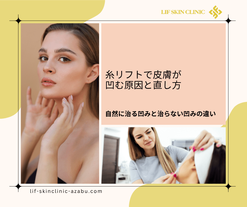 糸リフト凹み直し方