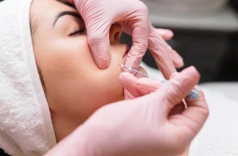 スレッドリフト画像イメージ