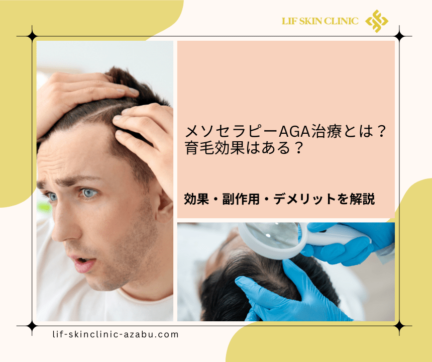 メソセラピーAGA