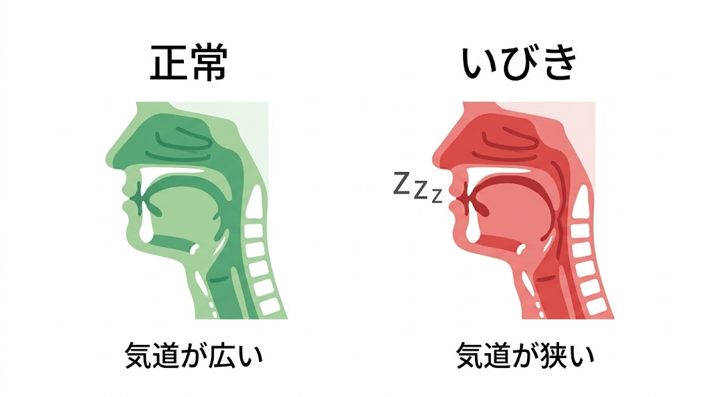 正常な気道といびき時の気道の比較図