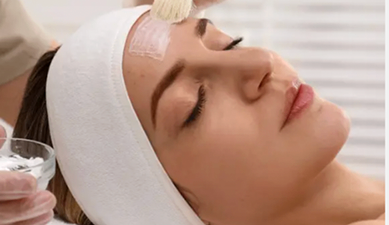 ケミカルピーリング